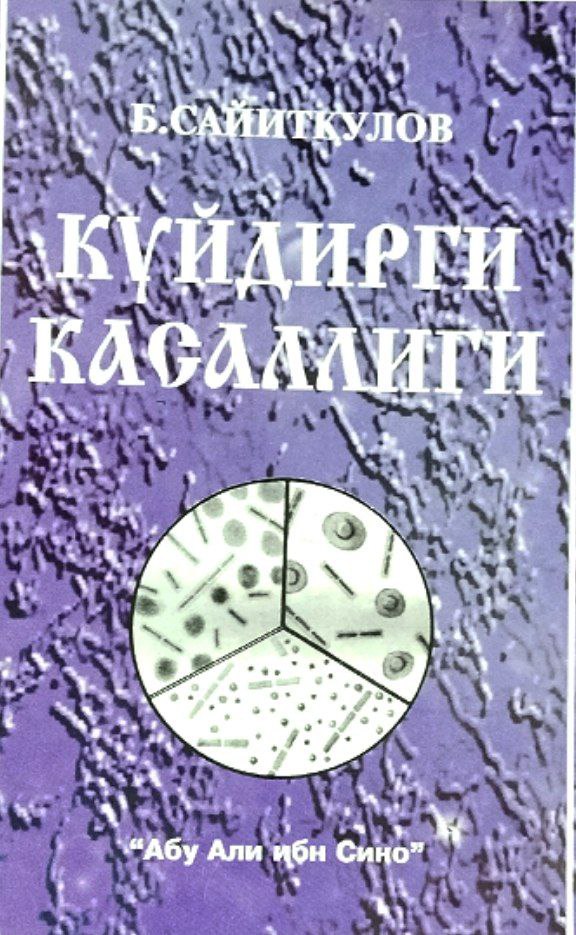 Куйдирги касаллиги